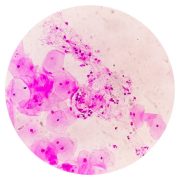 vaginal rejuvenation